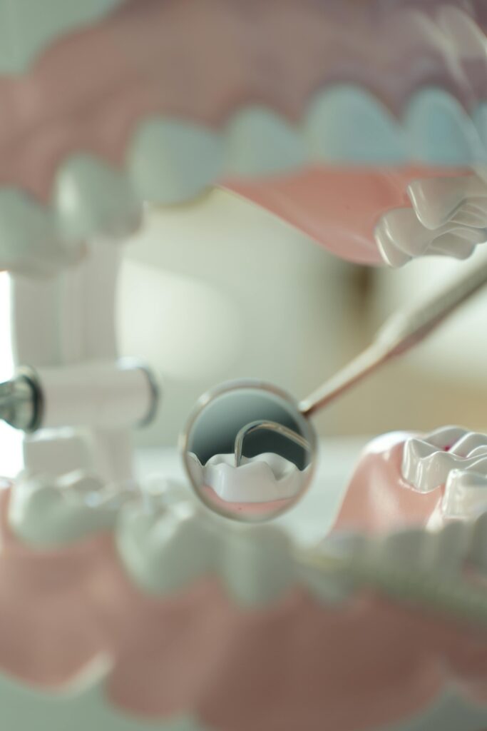 Detailed shot of dental tool examining model teeth, showcasing dental care concepts.